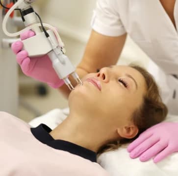 CO2 Laser Facials
