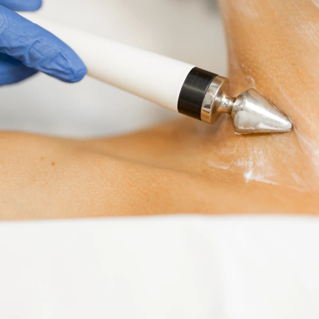 EMS / Microcurrent Body Treatment