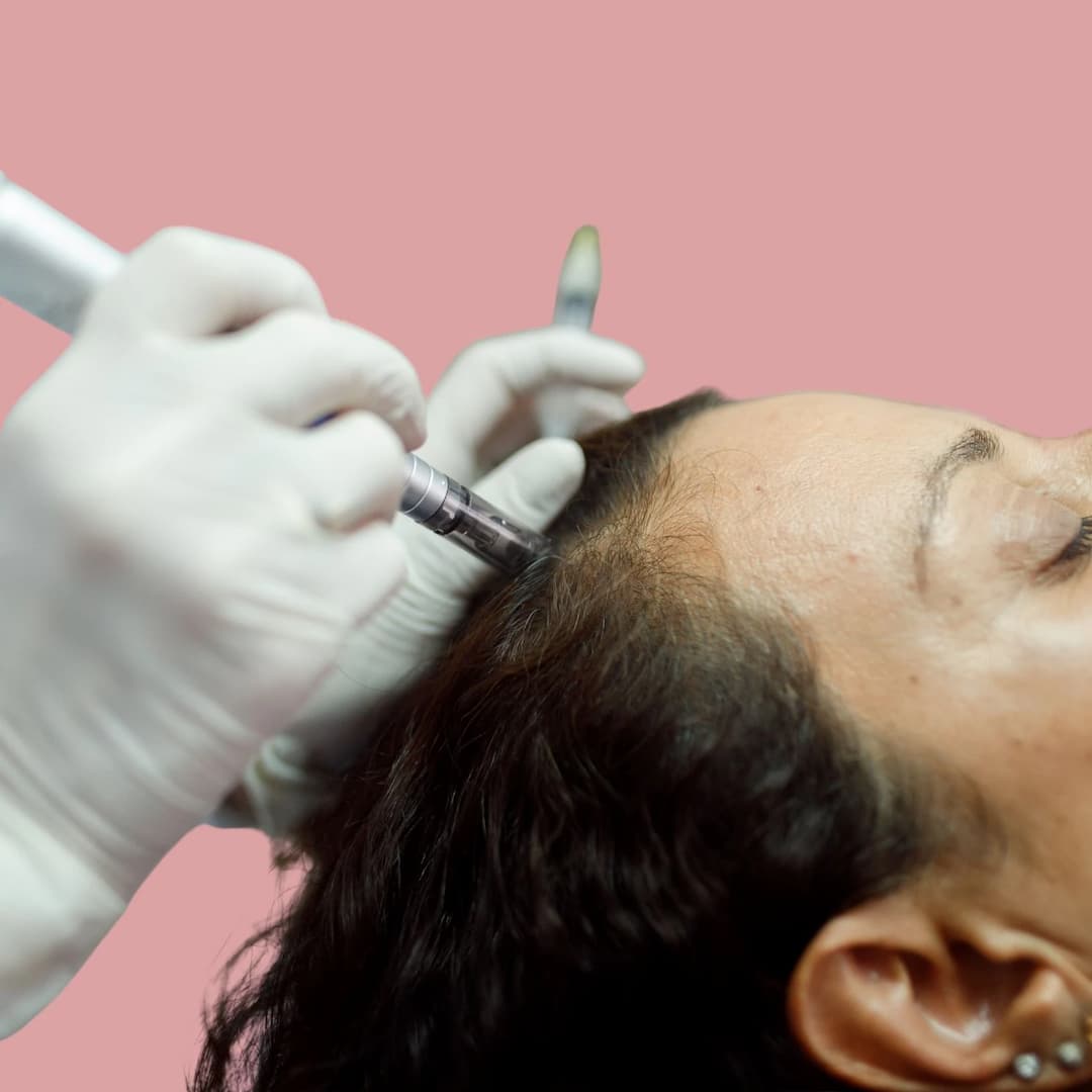 Hair Growth Microneedling