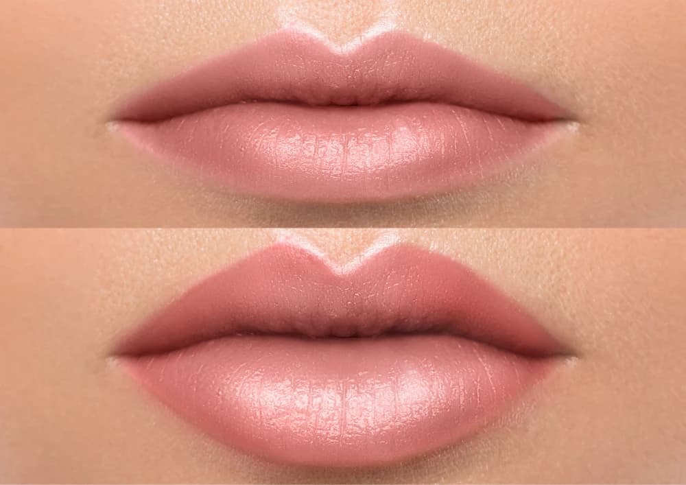 Natural Lip Enhance Plumping Course.