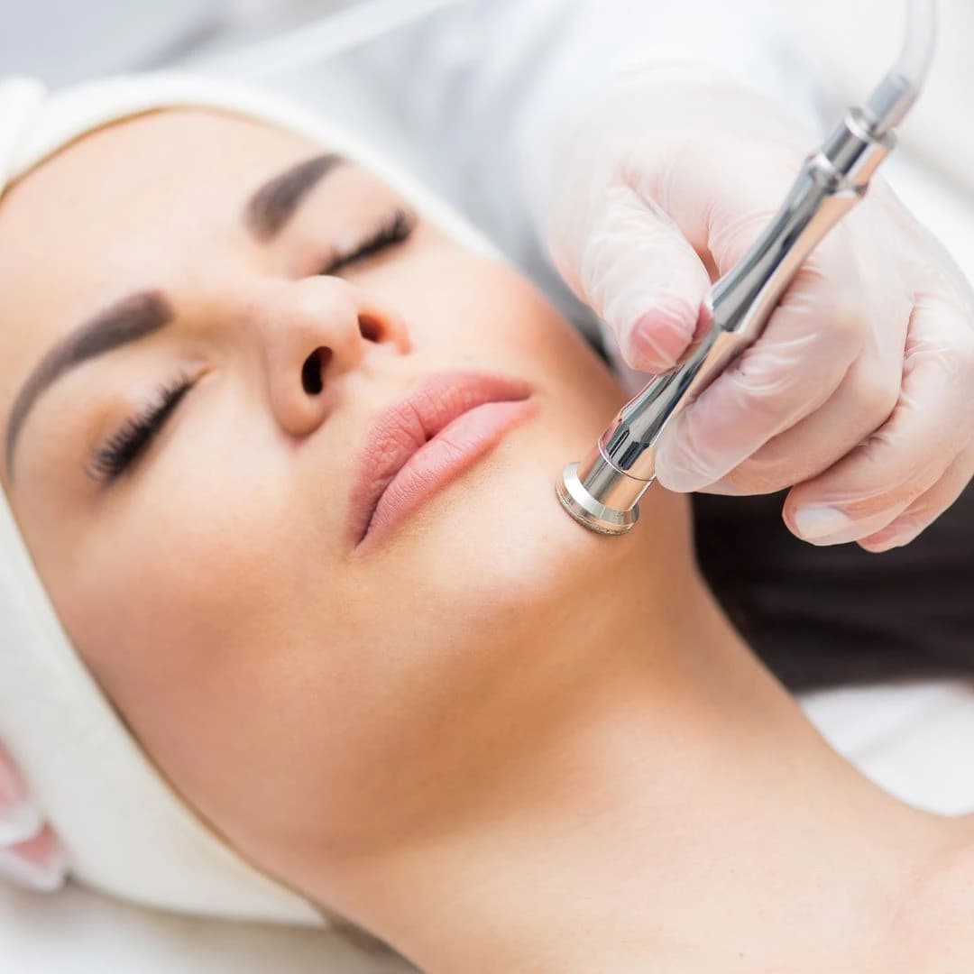 Glowing Skin Renewal with Microdermabrasion